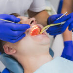 How Long After Dental Filling Can I Eat? A 2025 Guide to Recovery