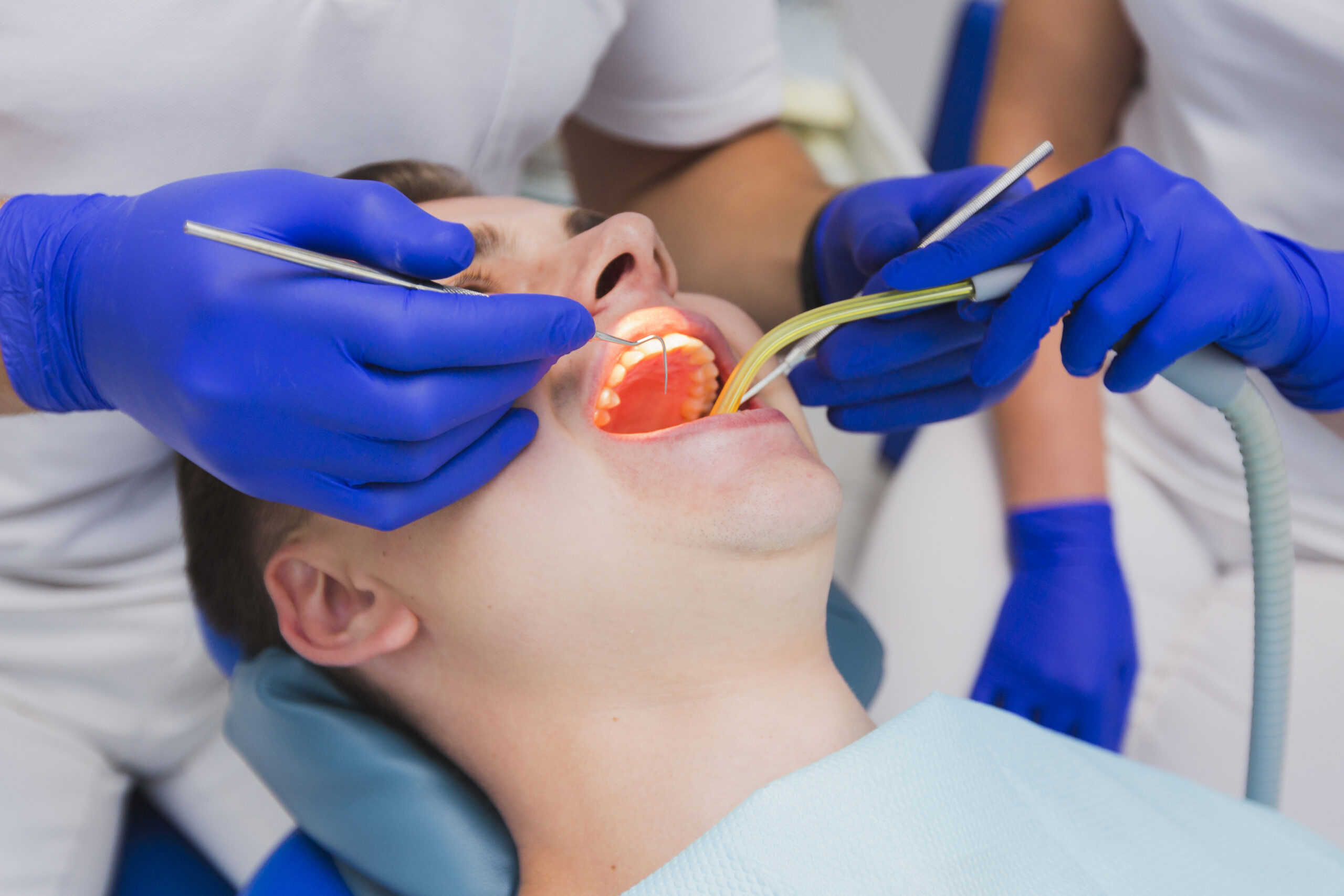 How Long After Dental Filling Can I Eat