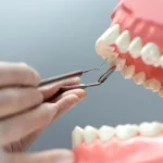 How Much Does a Dental Crown Cost?